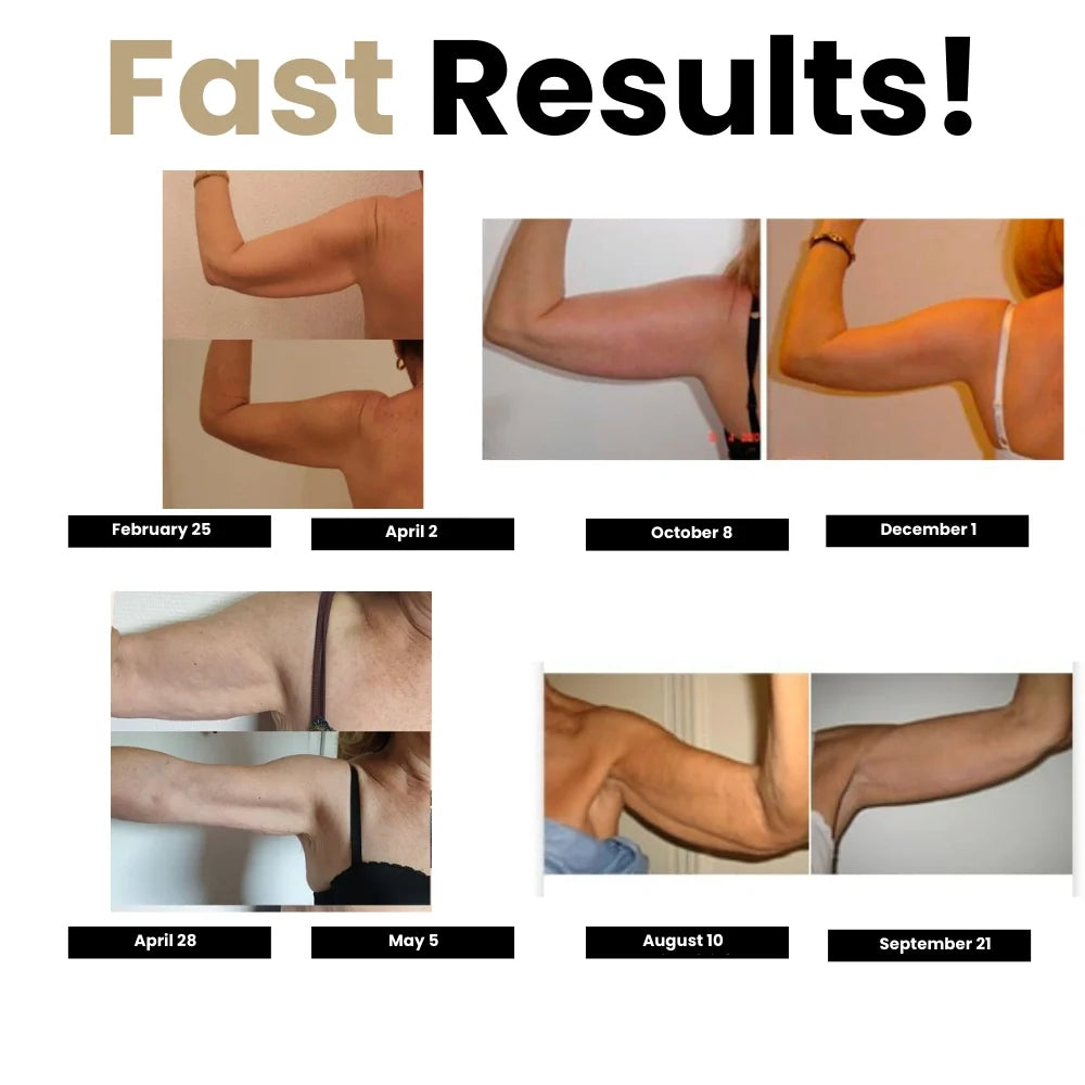 Silix™ 3D Compression Sleeves – Say Goodbye to Arm Jiggle